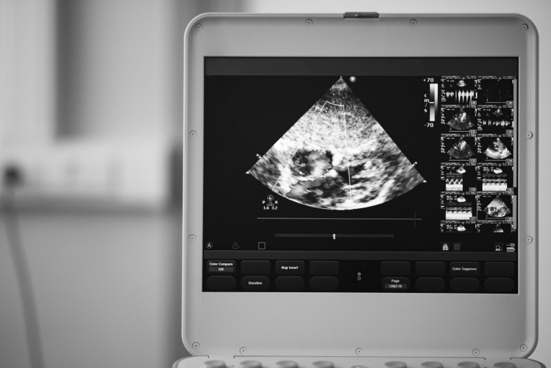 A Brief Summary of Four GE Ultrasound Devices and Their Applications