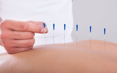 Uncover the Benefits of Acupuncture for Pain in Berkeley CA