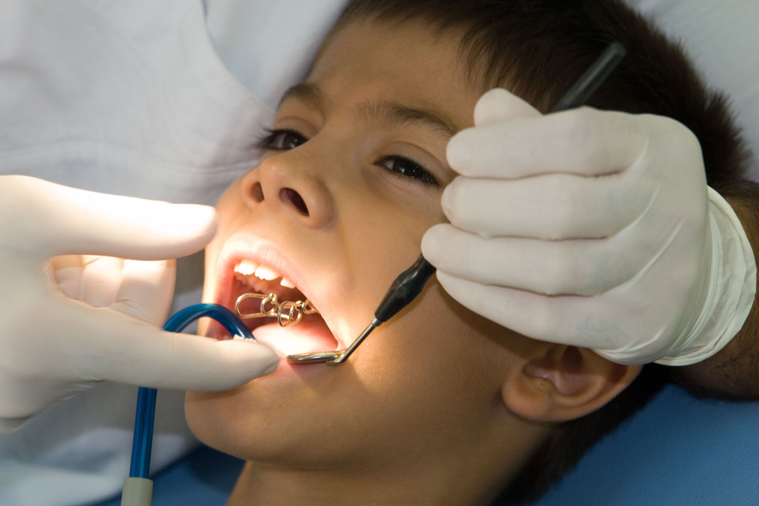 Finding Dental Services in Sugar Land
