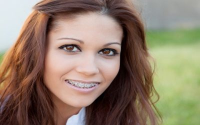 Straighten Your Smile Discreetly Using Clear Braces Fort Lauderdale, FL Options
