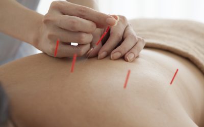 Experience Lasting Wellness Through Acupuncture Treatment Scottsdale AZ Residents Trust