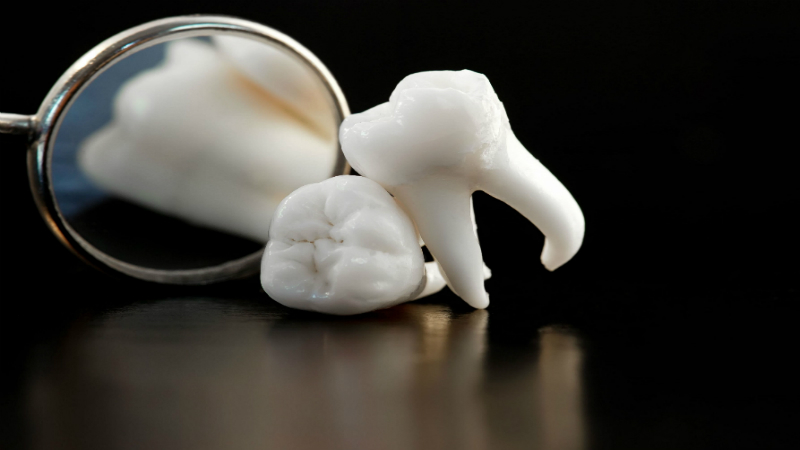 All Types of Cosmetic Dentistry in Miami Lakes Are Available to Enjoy