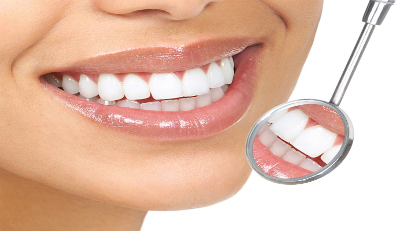 Common Questions on Teeth Whitening
