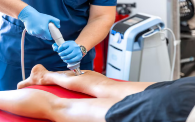 Is Shockwave Therapy the Answer for Your Tennis Elbow Pain in Placentia?