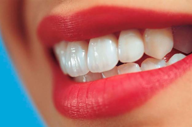 What You Need to Know About Teeth Whitening