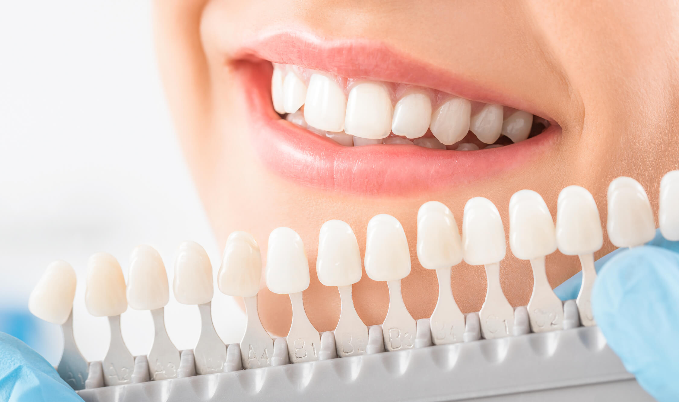 Visit Your Local Dentist to Improve the Appearance of Your Teeth