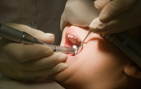 How to Find the Right Dentist in Bucks County for Your Implant Dentistry